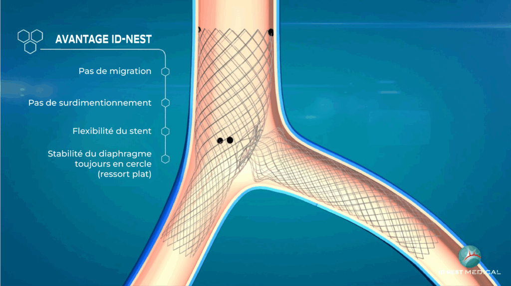 1 / 1 – fr- G_technologie_ID_VENOUS_SYSTEM_gauche.png